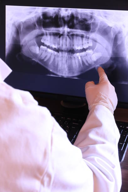 Best Broken or Chipped Tooth Repair in Marlboro, NY